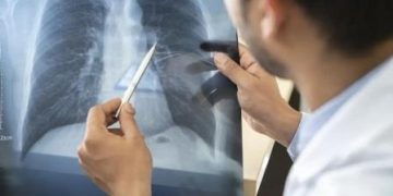 Tabagismo é maior entre jovens de 16 a 24 anos, alerta pesquisa